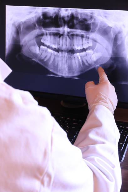 Best Tooth Infection Emergency Dentist  in Visalia, CA