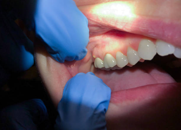 Best Dentist for Severe Toothache  in Visalia, CA